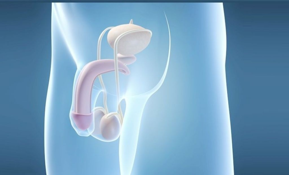Prosthesis implantation is a surgical method to enlarge the male penis. 